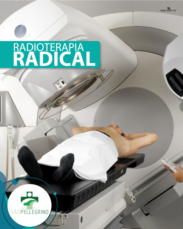 Radioterapia Radical