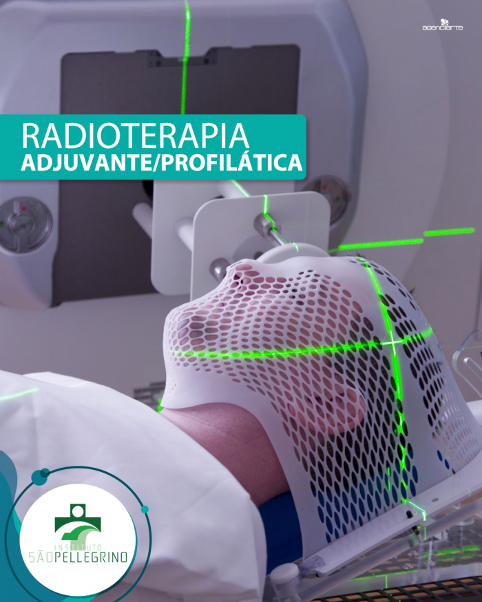 Radioterapia Adjuvante/Profilática