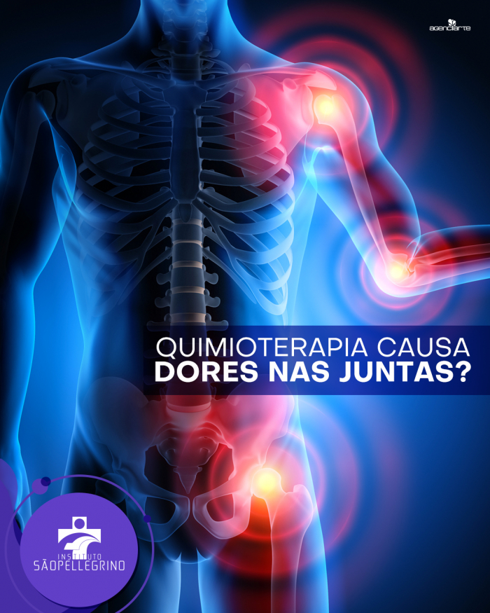 Quimioterapia causa dores nas juntas?