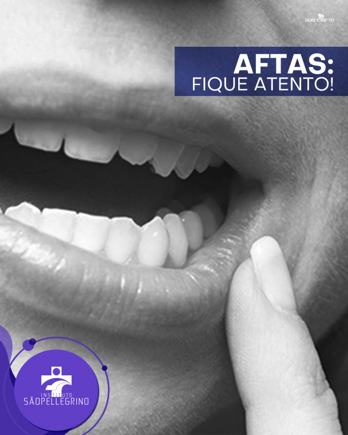 Aftas: fique atento!