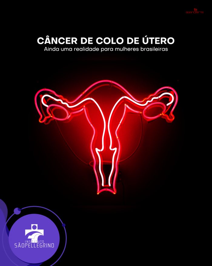 Câncer de colo de útero