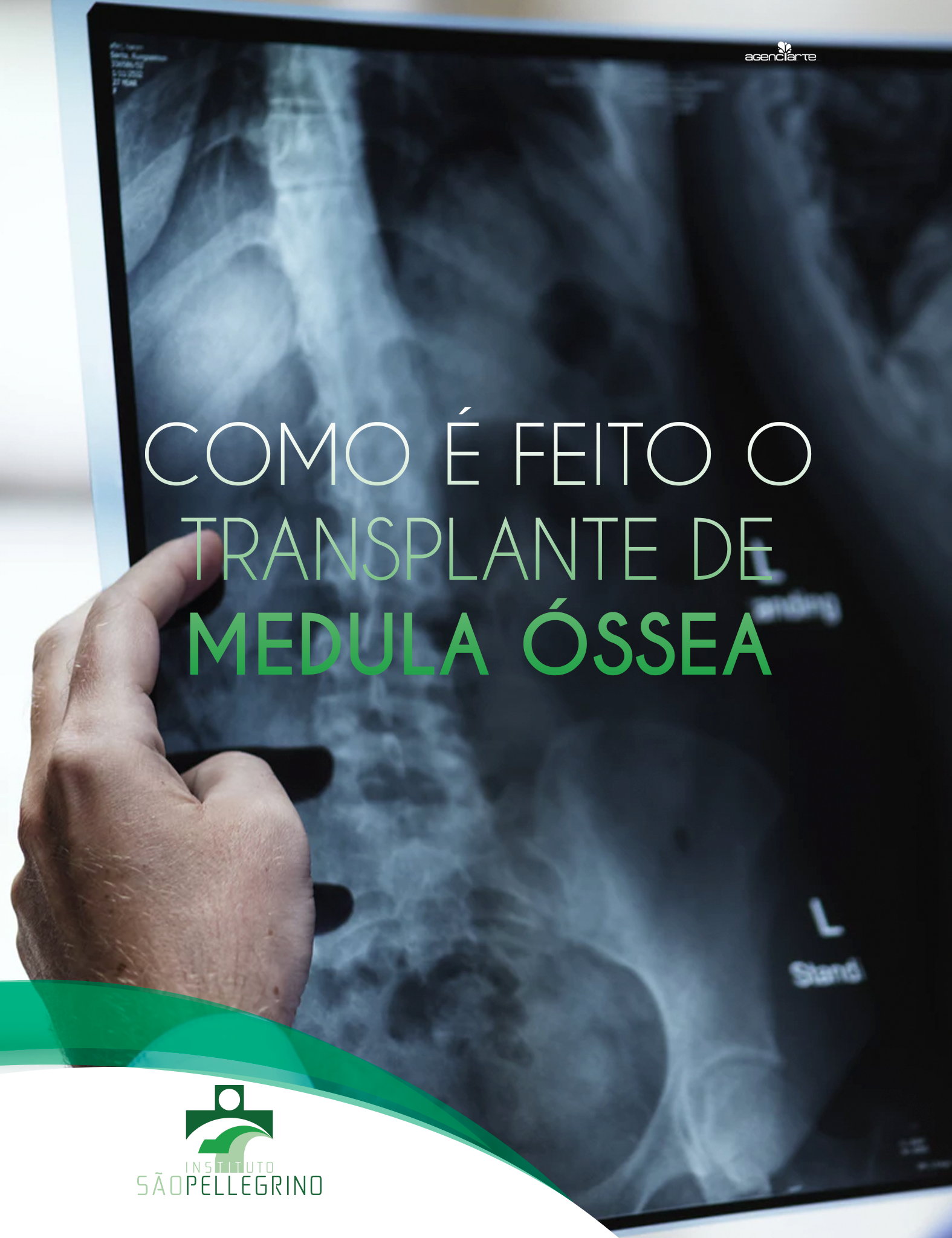 COMO É FEITO O TRANSPLANTE