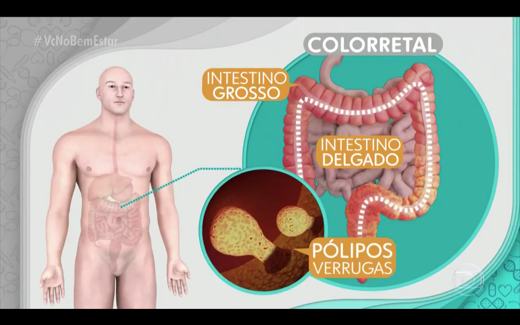 Diagnóstico precoce pode salvar a vida de quem está com câncer
