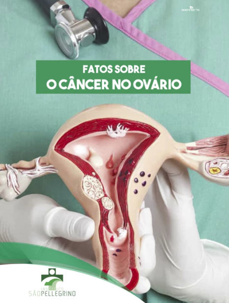FATOS SOBRE O CÂNCER NO OVÁRIO
