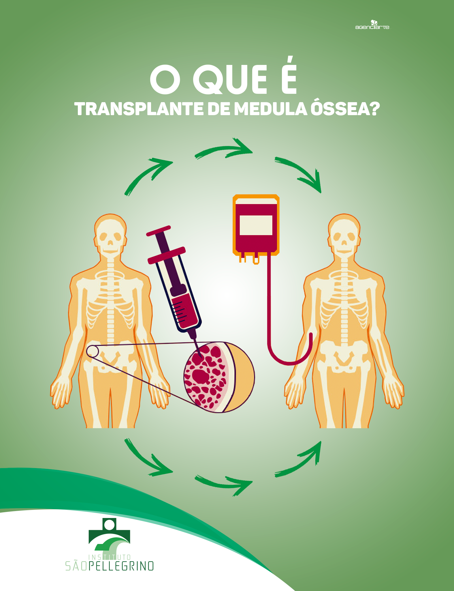 O QUE É TRANSPLANTE DE MEDULA ÓSSEA